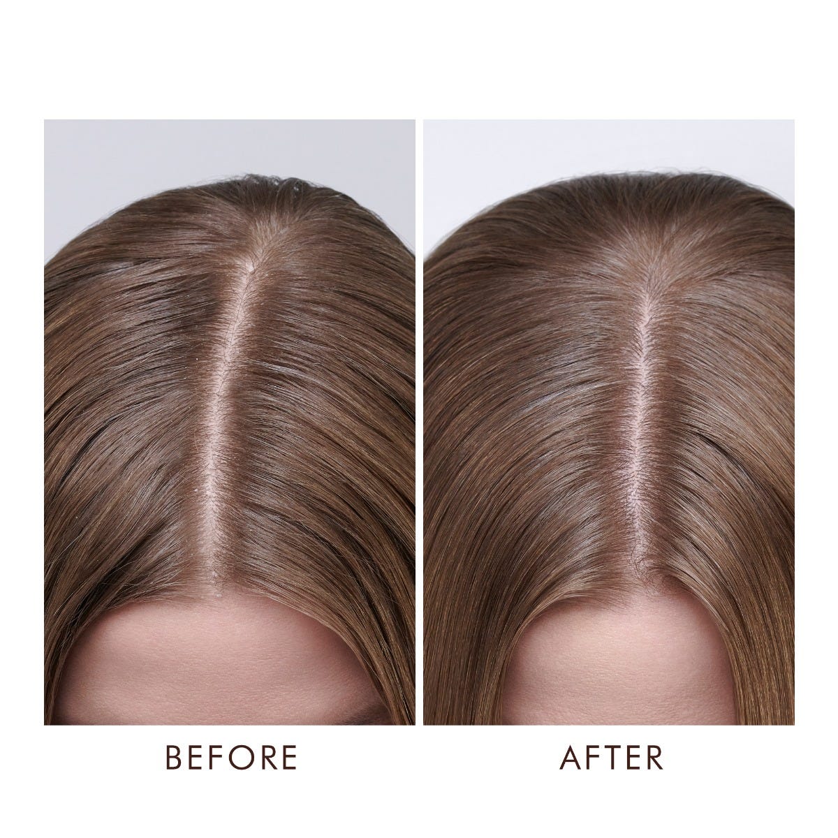 TRATAMIENTO MOROCCANOIL  DRY SCALPE 45 ML
