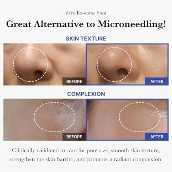 MEDICUBE 2024 ZERO PORE PAD 2.0