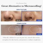 MEDICUBE 2024 ZERO PORE PAD 2.0
